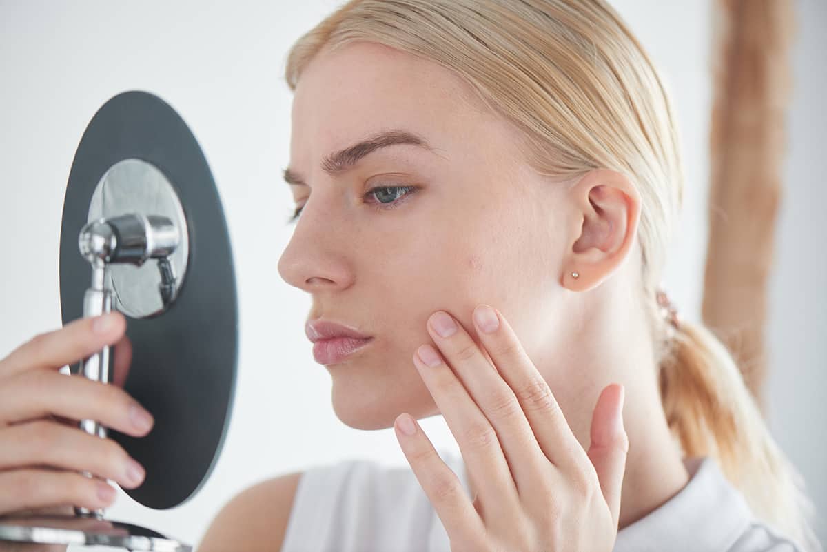 Acne-Pic