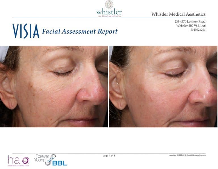 Katie-before-and-after-front-normal-copy-768x593