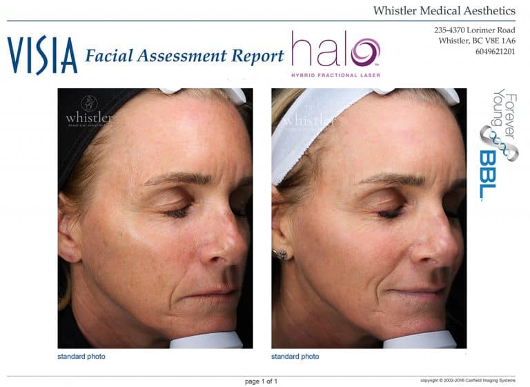 Lynne-Halo-websize-768x561
