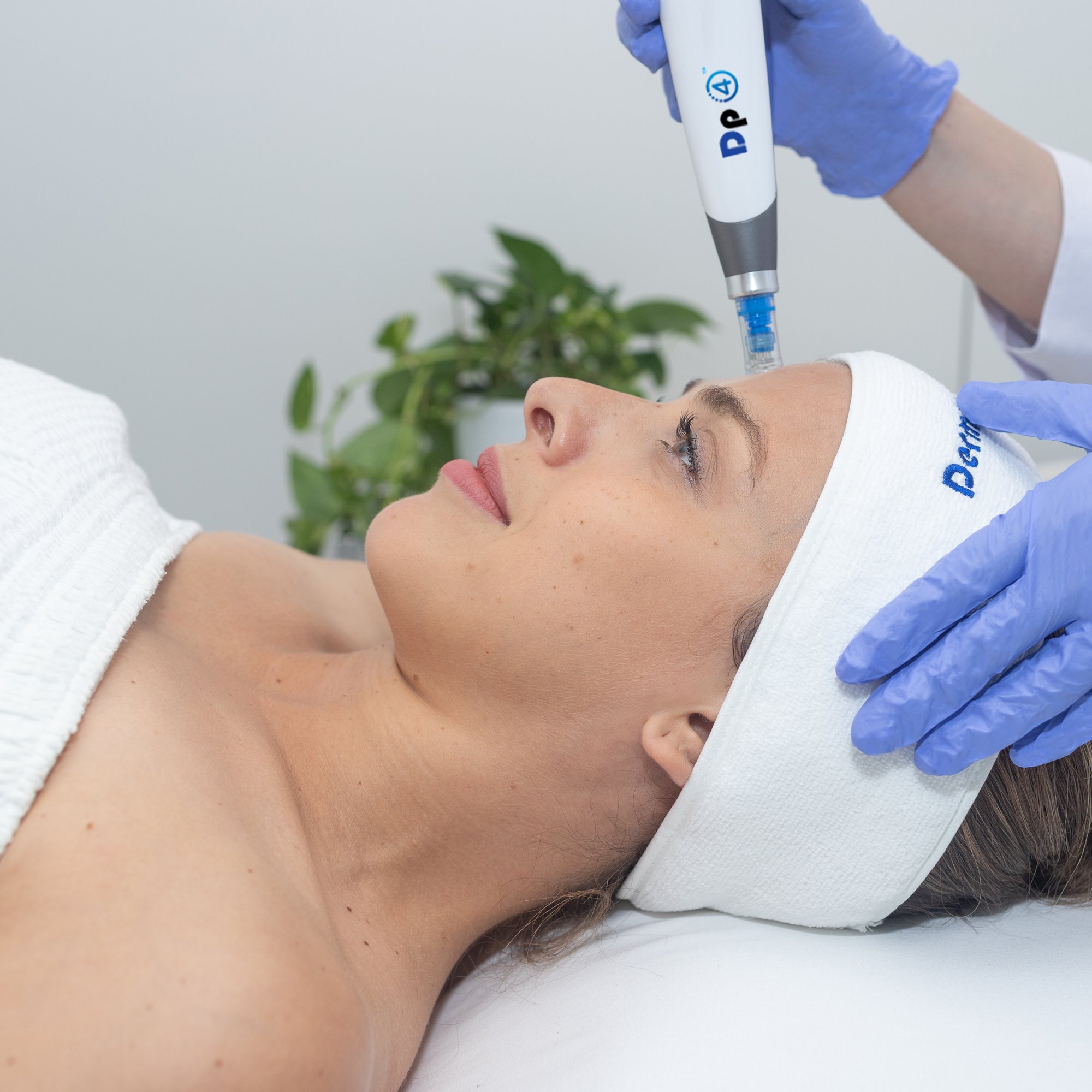 Woman at clinic receiving microneedling treatment