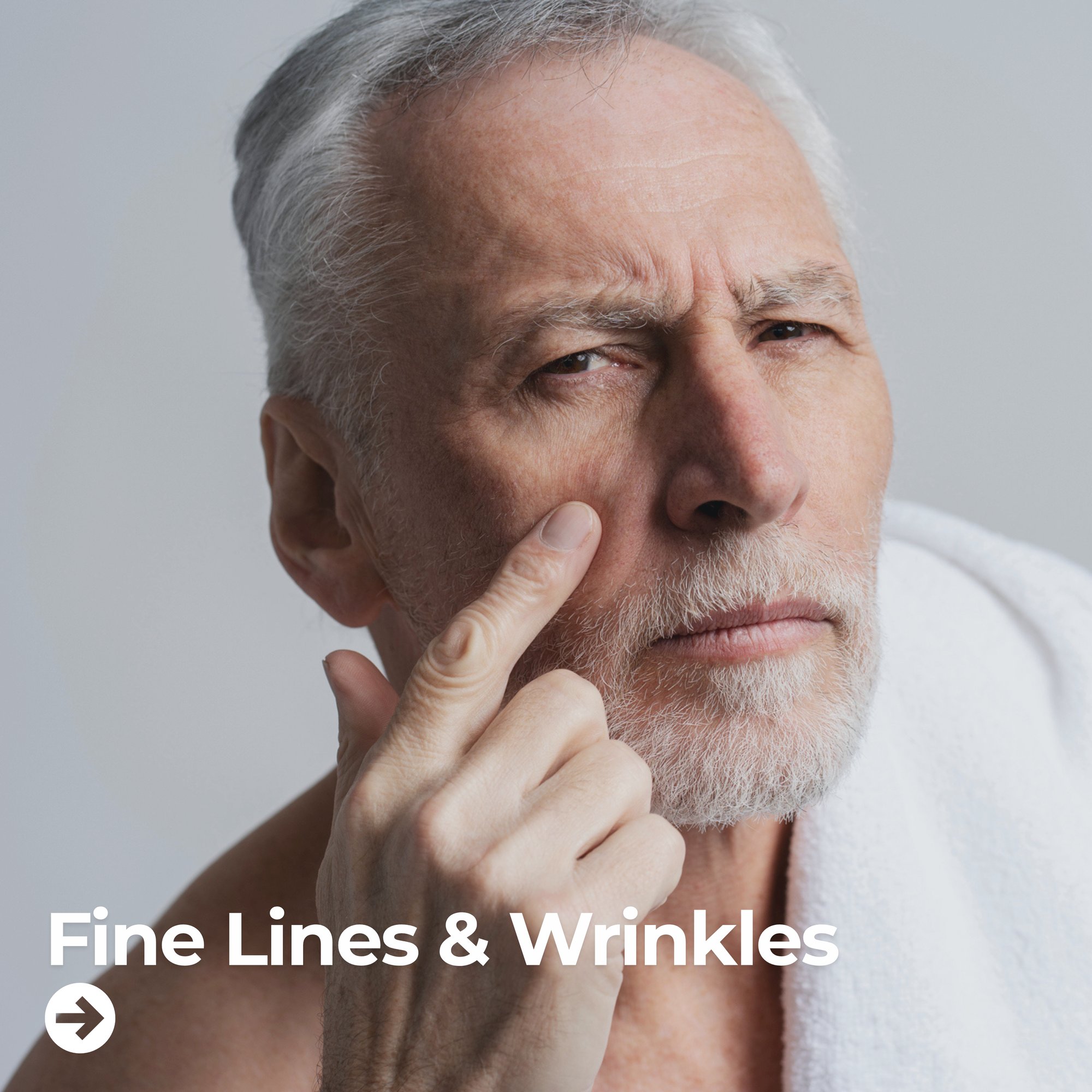 Fine Lines & Wrinkles
