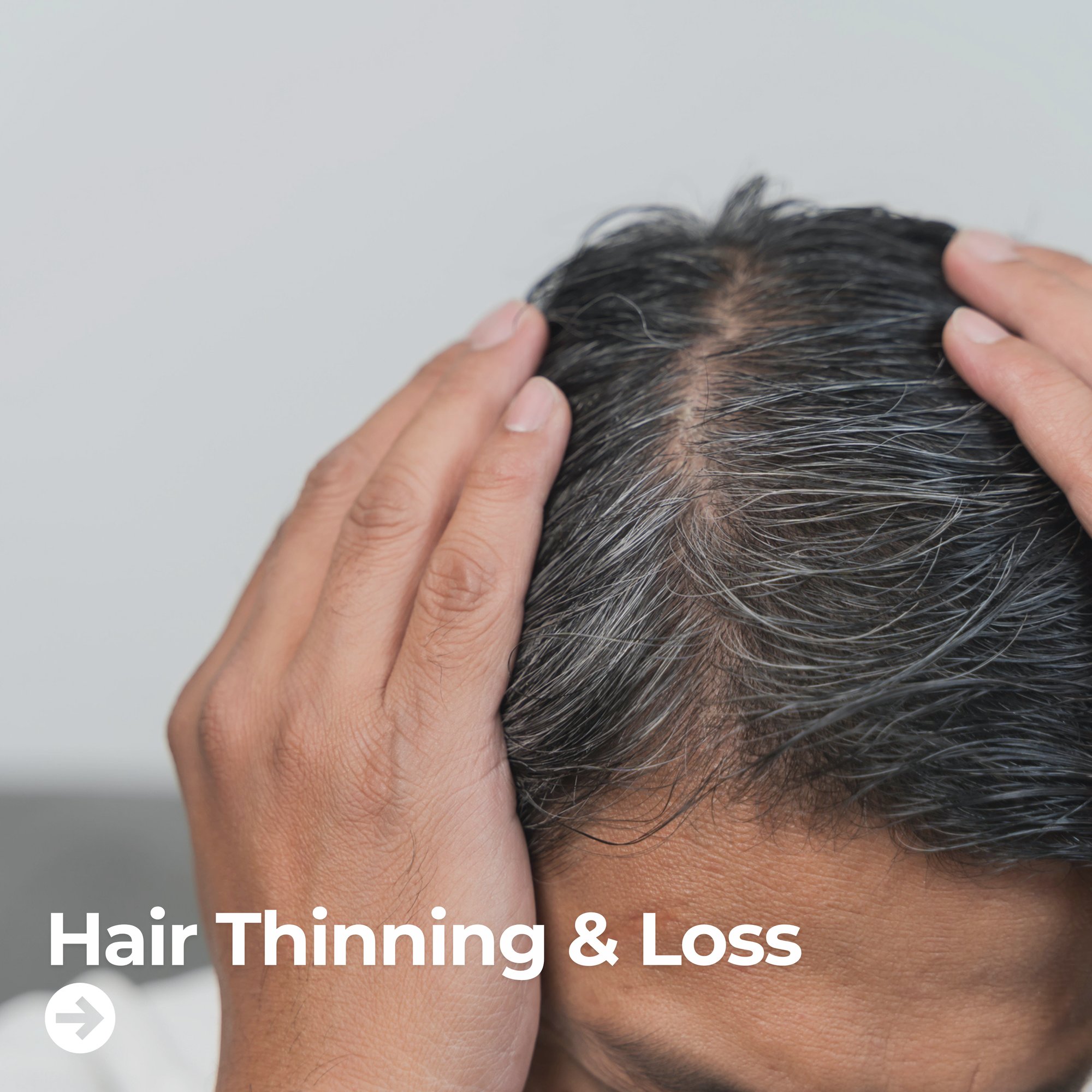 Hair Thinning & Loss