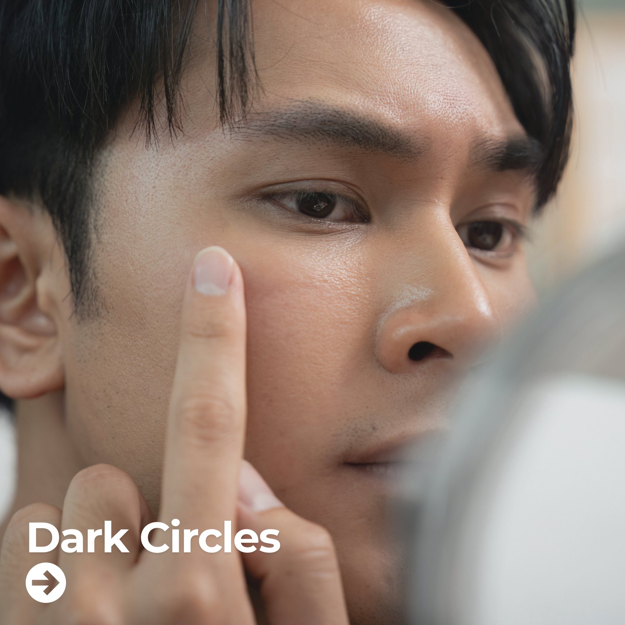 Dark Circles