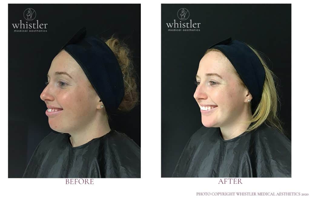 Lauren Full Face modulation