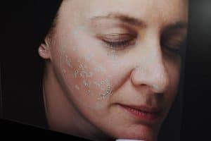 medical-aesthetics-skin-treatments-300x200