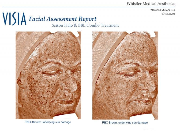 wendy-sun-damage-websize-side-by-side-768x561