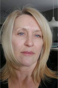 Beverly  Age 70 After treatment