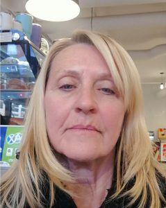 Beverly  Age 70 Before treatment