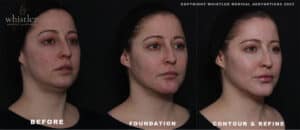 CARLEIGH-FOUNDATION-TO-CONTOUR-MD-CODES-300x130