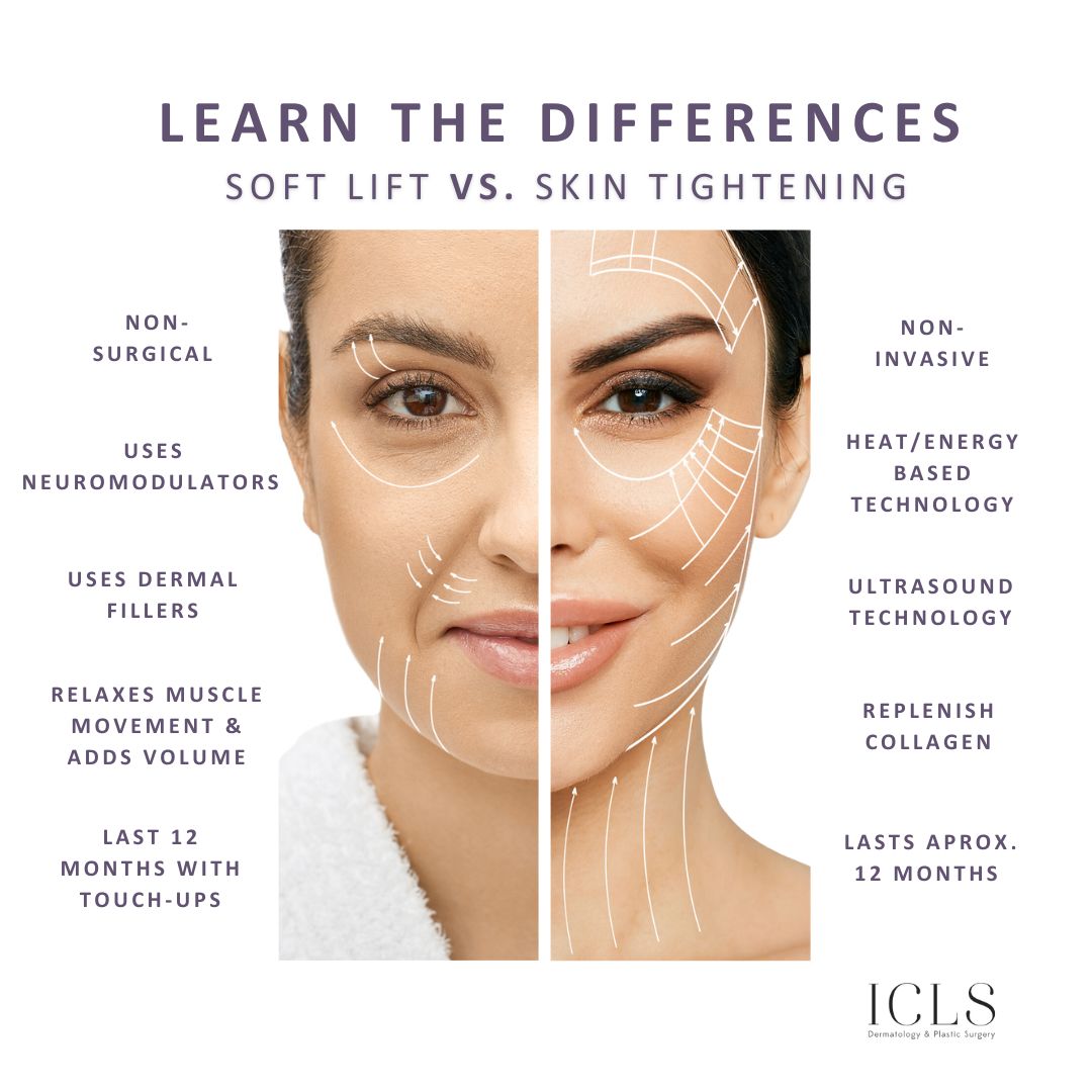 ICLS-Infographic-SkinTighteningVs.Softlift-Aug2023
