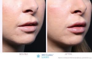 Lips by Dr Kennea