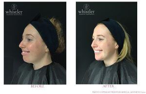 Lauren Full Face modulation