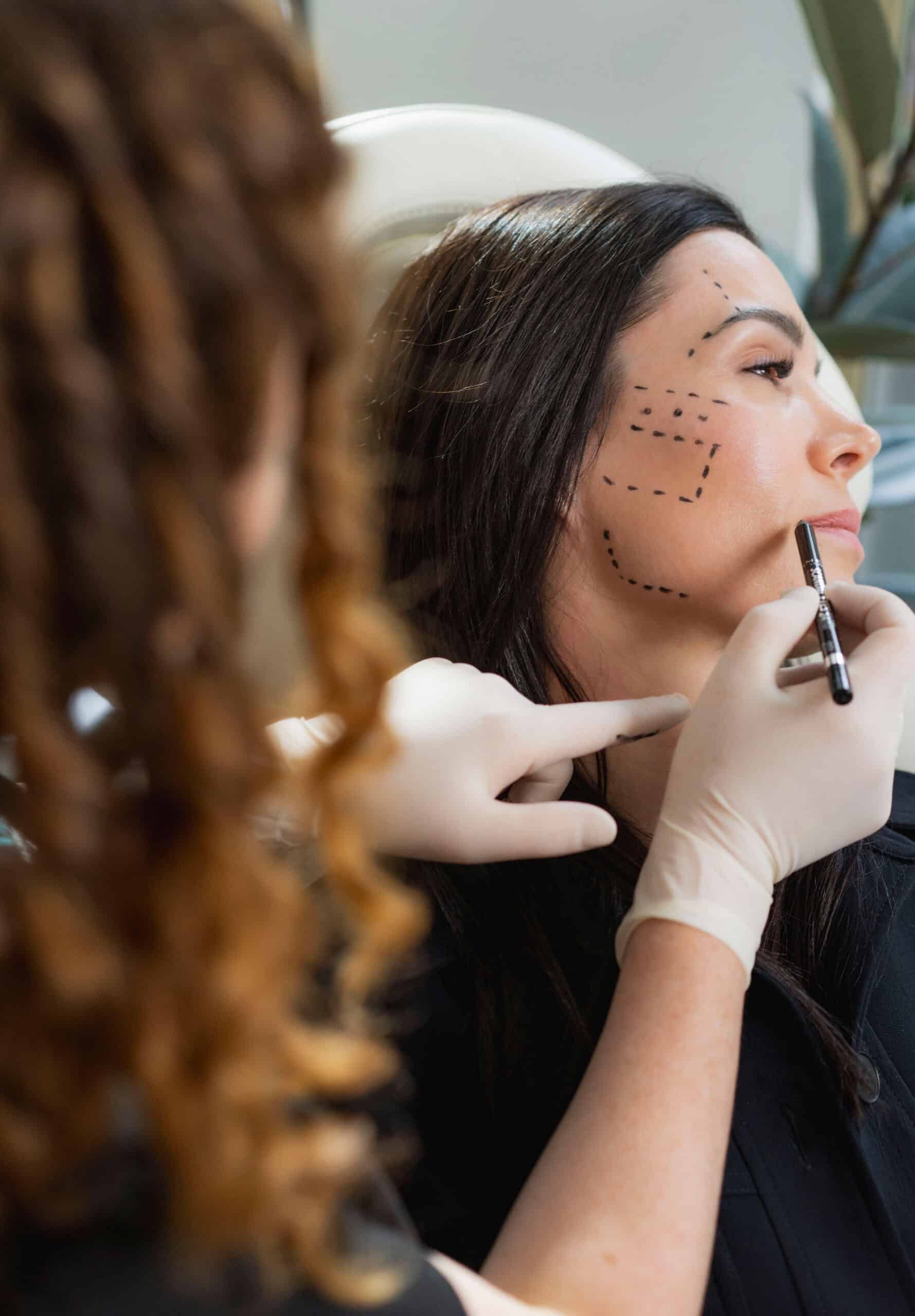 Botox - Cosmetic