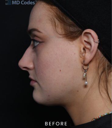 before treatment