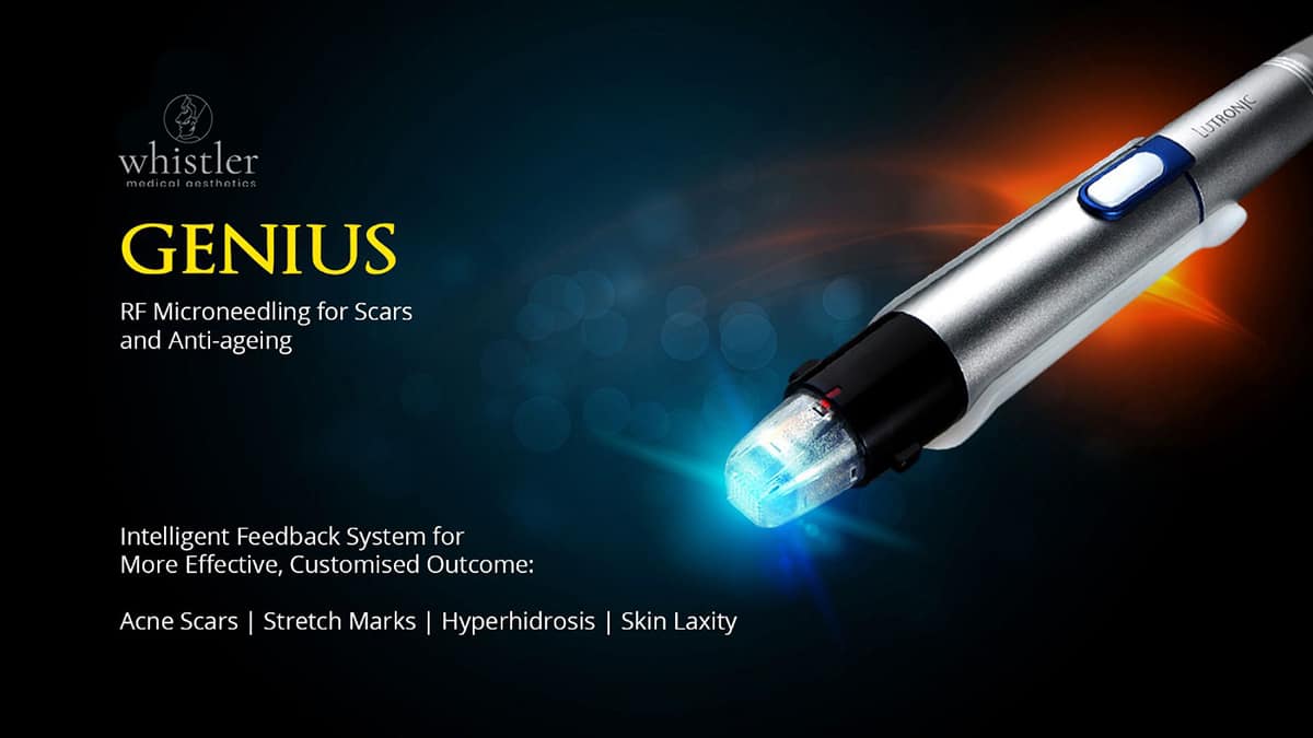 Frantsuz aktrisasi Mylen Jampanoi yalangoch