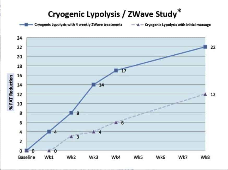 Coolsculpting with Zwave for optimum results