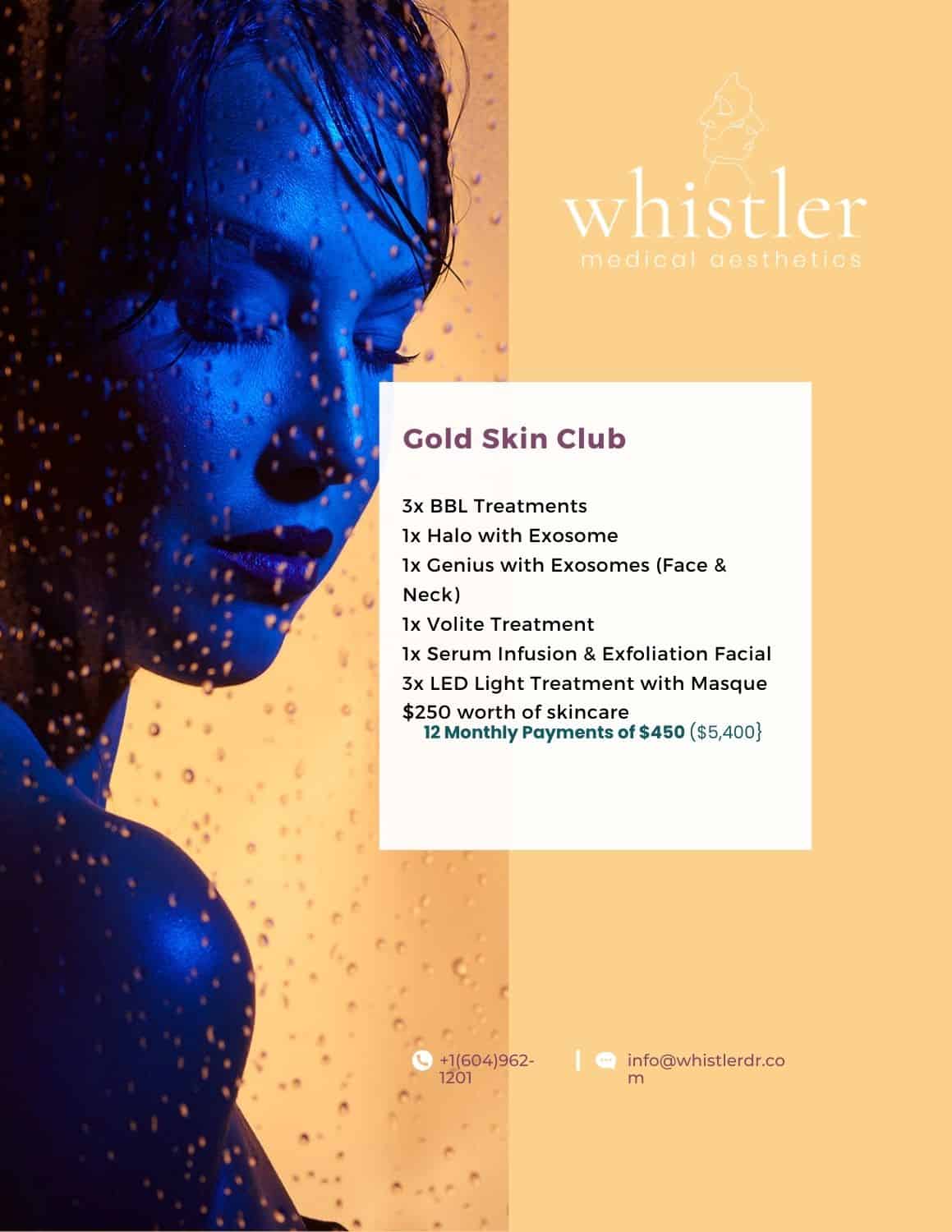 gold-skin-club