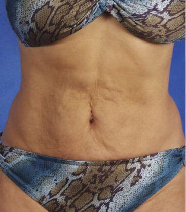 before treatment
