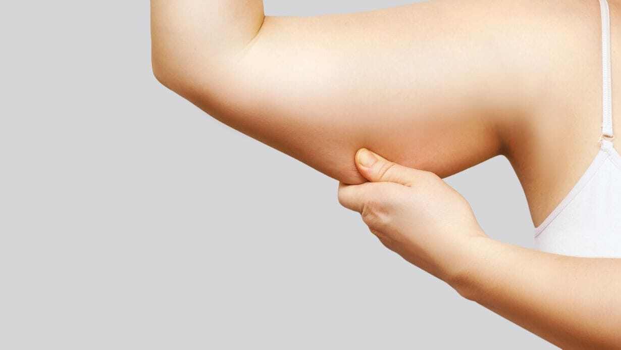 CoolSculpting Underarms