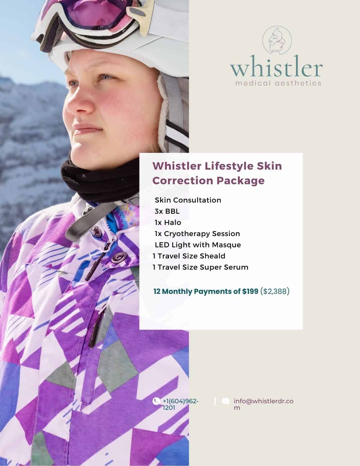 histler-lifestyle