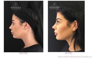 Young female jawline
