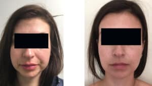 massiters B & F eyes only